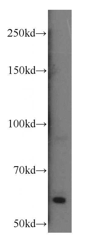 HL-60 cells were subjected to SDS PAGE followed by western blot with Catalog No:108816(CASR antibody) at dilution of 1:400