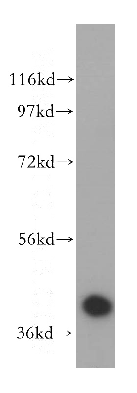 HeLa cells were subjected to SDS PAGE followed by western blot with Catalog No:114000(POLDIP2 antibody) at dilution of 1:500