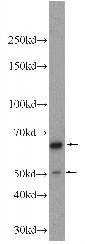 rat brain tissue were subjected to SDS PAGE followed by western blot with Catalog No:109208(CHAT Antibody) at dilution of 1:1000