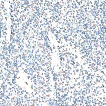 Immunohistochemistry - RBM17 Polyclonal Antibody 