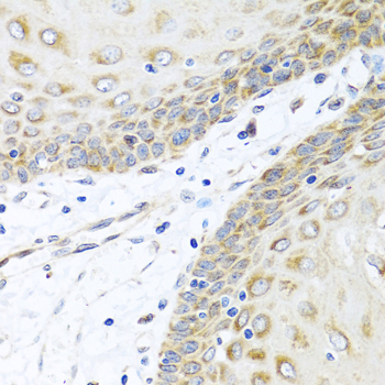 Immunohistochemistry - INHBC Polyclonal Antibody 