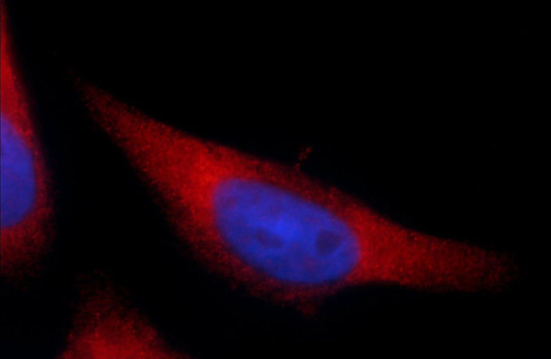 Immunofluorescent analysis of A431 cells using Catalog No:115286(SIDT1 Antibody) at dilution of 1:25 and Rhodamine-Goat anti-Rabbit IgG