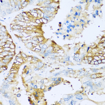 Immunohistochemistry - APOC1 Polyclonal Antibody 