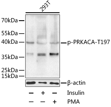 Western blot - Phospho-PRKACA-T197 pAb 