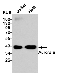 Western blot analysis of Aurora B expression in Jurkat and Hela cell lysates using Aurora B antibody at 1/1000 dilution.Predicted band size:39KDa.Observed band size:39KDa.