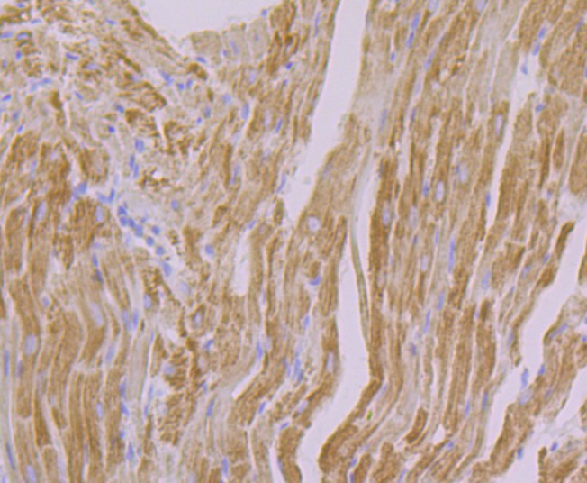 Fig2:; Immunohistochemical analysis of paraffin-embedded rat heart tissue using anti-NDUFB8 antibody. The section was pre-treated using heat mediated antigen retrieval with Tris-EDTA buffer (pH 8.0-8.4) for 20 minutes.The tissues were blocked in 5% BSA for 30 minutes at room temperature, washed with ddH; 2; O and PBS, and then probed with the primary antibody ( 1/50) for 30 minutes at room temperature. The detection was performed using an HRP conjugated compact polymer system. DAB was used as the chromogen. Tissues were counterstained with hematoxylin and mounted with DPX.