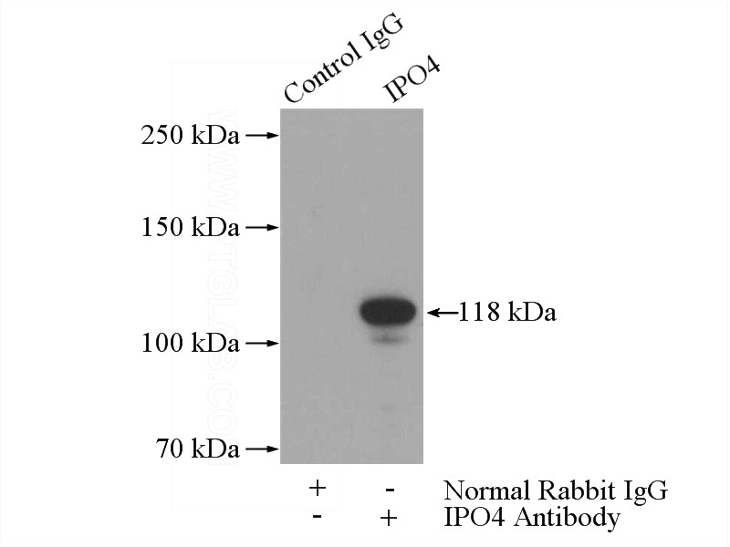 IP Result of anti-IPO4 (IP:Catalog No:111820, 5ug; Detection:Catalog No:111820 1:500) with mouse testis tissue lysate 4000ug.