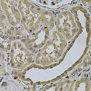 Immunohistochemistry - LCP1 Polyclonal Antibody 