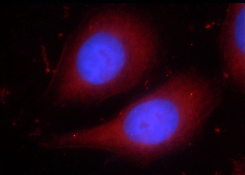 Immunofluorescent analysis of HepG2 cells using Catalog No:114081(PPARG Antibody) at dilution of 1:25 and Rhodamine-Goat anti-Rabbit IgG