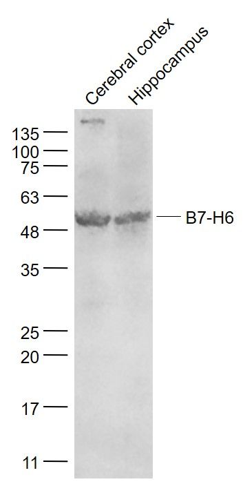 Fig4: Sample:; Cerebral cortex (Mouse) Lysate at 40 ug; Hippocampus (Mouse) Lysate at 40 ug; Primary: Anti- B7-H6 at 1/1000 dilution; Secondary: IRDye800CW Goat Anti-Rabbit IgG at 1/20000 dilution; Predicted band size: 48 kD; Observed band size: 50 kD