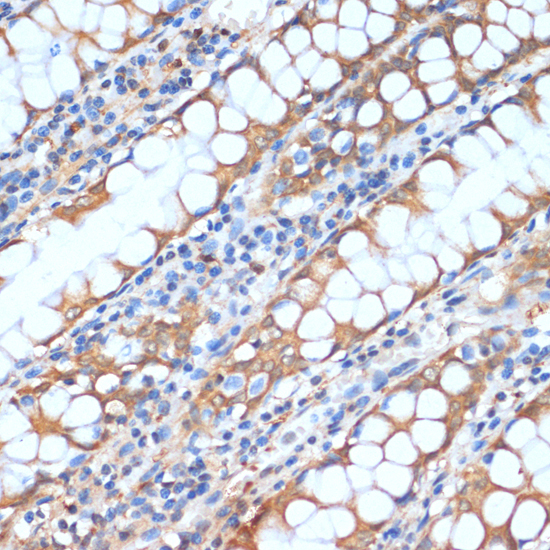 Immunohistochemistry - HHLA2 Polyclonal Antibody 
