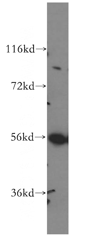 Jurkat cells were subjected to SDS PAGE followed by western blot with Catalog No:112172(LCK antibody) at dilution of 1:500