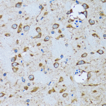 Immunohistochemistry - PDP1 Polyclonal Antibody 