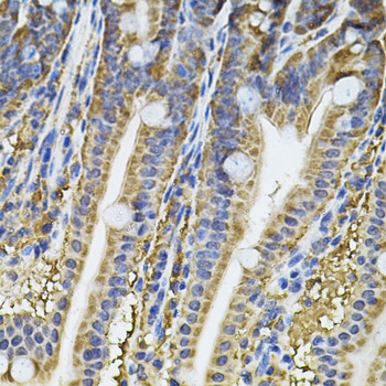 Immunohistochemistry - NFU1 Polyclonal Antibody 