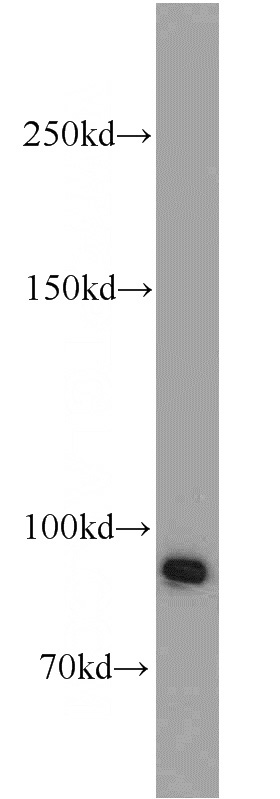 human testis tissue were subjected to SDS PAGE followed by western blot with Catalog No:117224(BRCA1 antibody) at dilution of 1:1000