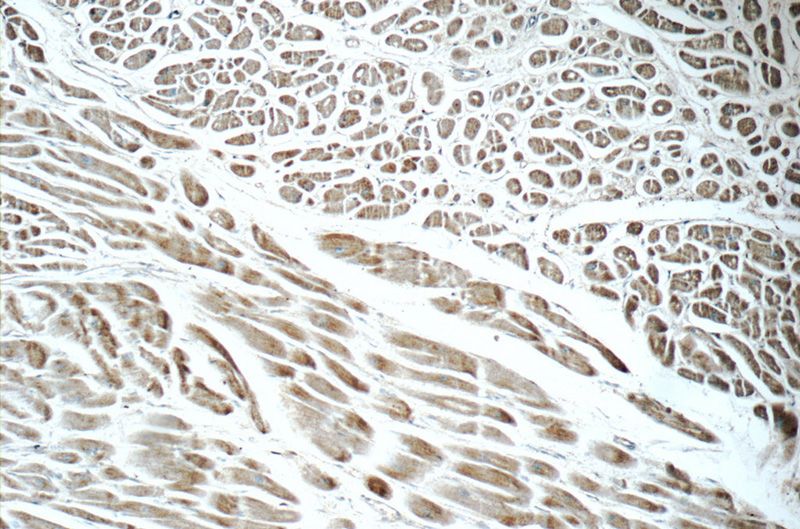Immunohistochemistry of paraffin-embedded human heart tissue slide using Catalog No:110547(FBXO17 Antibody) at dilution of 1:50 (under 10x lens)
