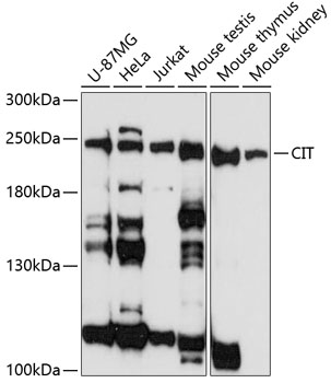 Western blot - CIT Polyclonal Antibody 