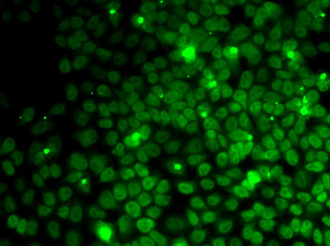 Immunofluorescence - UFD1L Polyclonal Antibody. Immunofluorescence analysis of MCF7 cells using UFD1L antibody .