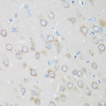 Immunohistochemistry - GPI Polyclonal Antibody 