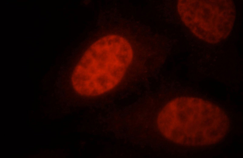 Immunofluorescent analysis of HepG2 cells, using SMARCA4 antibody Catalog No:115427 at 1:25 dilution and Rhodamine-labeled goat anti-rabbit IgG (red).