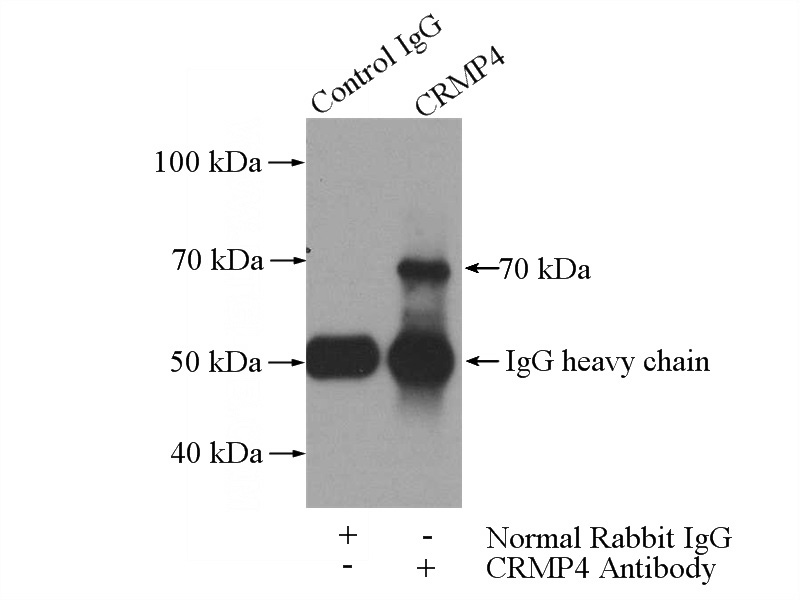 IP Result of anti-DPYSL3 (IP:Catalog No:109573, 3ug; Detection:Catalog No:109573 1:700) with SH-SY5Y cells lysate 3000ug.