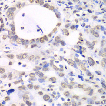 Immunohistochemistry - NONO Polyclonal Antibody 