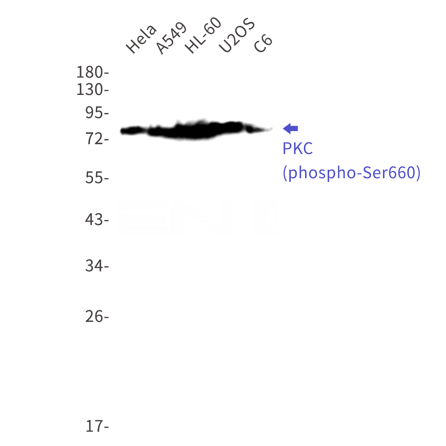Western blot detection of PKC (phospho-Ser660) in Hela,A549,HL-60,U2OS,C6 cell lysates using PKC (phospho-Ser660) Rabbit mAb(1:1000 diluted).Predicted band size:78kDa.Observed band size:78-85kDa.