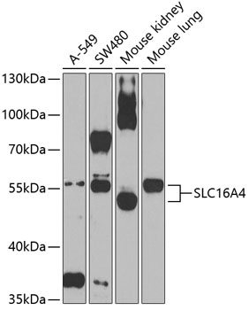 Western blot - SLC16A4 Polyclonal Antibody 