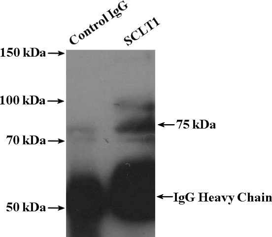 IP Result of anti-SCLT1 (IP:Catalog No:114999, 4ug; Detection:Catalog No:114999 1:1000) with human placenta tissue lysate 4000ug.