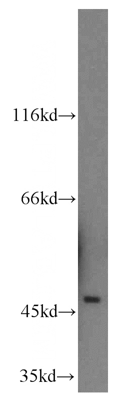 mouse brain tissue were subjected to SDS PAGE followed by western blot with Catalog No:113132(SERPINI1 antibody) at dilution of 1:500