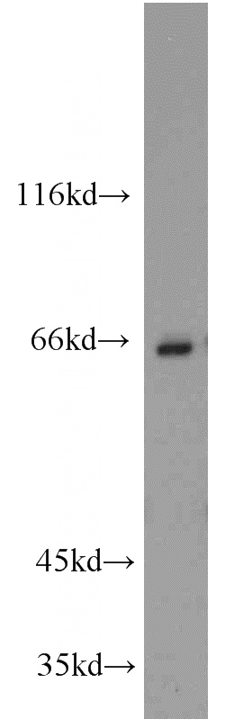 Jurkat cells were subjected to SDS PAGE followed by western blot with Catalog No:108897(CBFA2T3 antibody) at dilution of 1:1000
