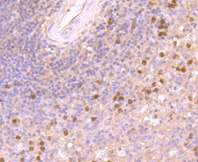 Fig8: Immunohistochemical analysis of paraffin-embedded human spleen tissue using anti-IL7 antibody. Counter stained with hematoxylin.