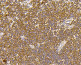 Fig5: Immunohistochemical analysis of paraffin- embedded human spleen tissue using anti-FPR2 rabbit polyclonal antibody.