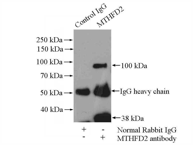 IP Result of anti-MTHFD2 (IP:Catalog No:112778, 4ug; Detection:Catalog No:112778 1:300) with mouse testis tissue lysate 4000ug.