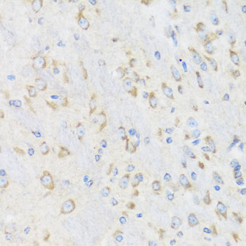 Immunohistochemistry - CHIC2 Polyclonal Antibody 