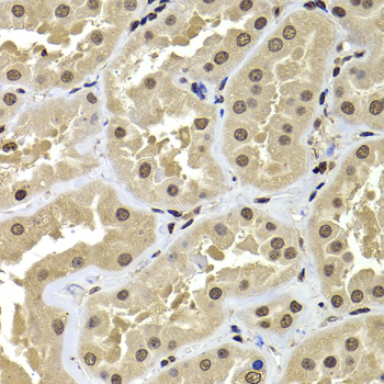 Immunohistochemistry - ACTL6B Polyclonal Antibody 