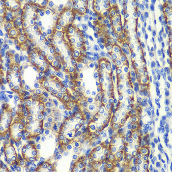 Immunohistochemistry - ZFAND3 Polyclonal Antibody 