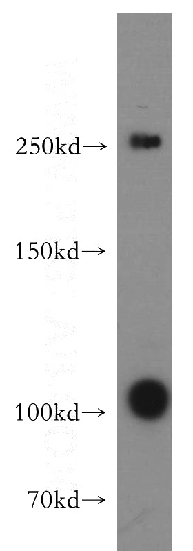human testis tissue were subjected to SDS PAGE followed by western blot with Catalog No:115984(TAF1L antibody) at dilution of 1:800