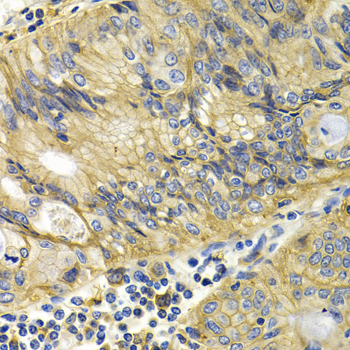 Immunohistochemistry - KLKB1 Polyclonal Antibody 