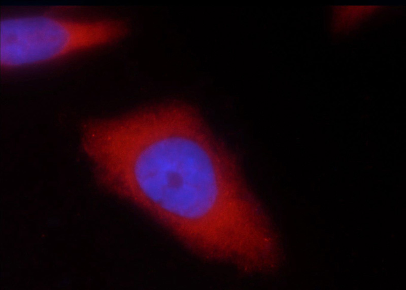 Immunofluorescent analysis of HeLa cells using Catalog No:116544(UBE4B Antibody) at dilution of 1:25 and Rhodamine-Goat anti-Rabbit IgG