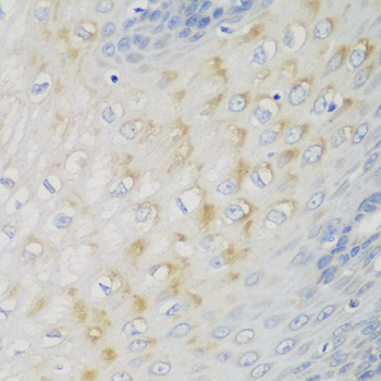 Immunohistochemistry - NME4 Polyclonal Antibody 