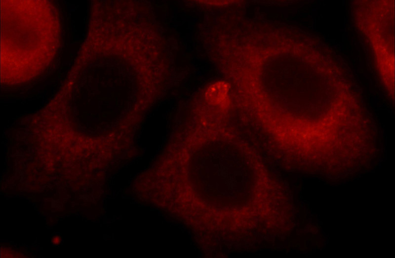 Immunofluorescent analysis of HeLa cells using Catalog No:113995(POGK Antibody) at dilution of 1:25 and Rhodamine-Goat anti-Rabbit IgG