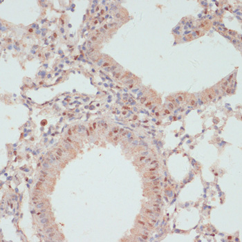 Immunohistochemistry - Phospho-PEA15-S104 pAb 