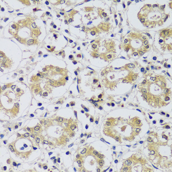 Immunohistochemistry - C12orf10 Polyclonal Antibody 