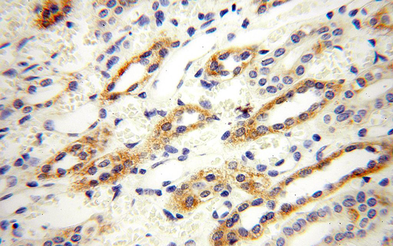 Immunohistochemical of paraffin-embedded human kidney using Catalog No:110960(GGPS1 antibody) at dilution of 1:100 (under 40x lens)