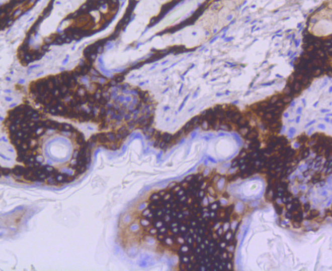 Immunohistochemistry - KRT15 Monoclonal Antibody 