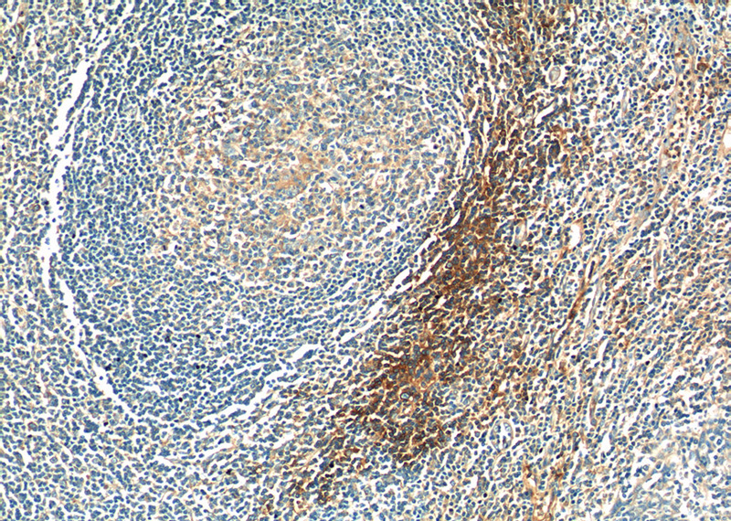 Immunohistochemistry of paraffin-embedded human tonsillitis tissue slide using Catalog No:115209(SERPING1 Antibody) at dilution of 1:50 (under 10x lens)