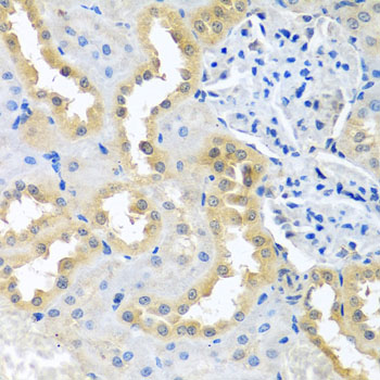 Immunohistochemistry - BCKDK Polyclonal Antibody 