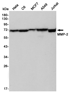 Western blot detection of MMP-2 in Hela,C6,MCF7,A549 and Jurkat cell lysates using MMP-2 mouse mAb (1:5000 diluted).Predicted band size:74KDa.Observed band size:72KDa.