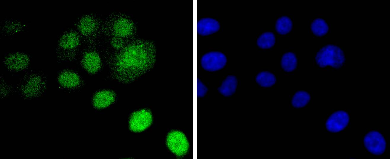 Fig1:; ICC staining Histone H2B(mono methyl R79) in HepG2 cells (green). The nuclear counter stain is DAPI (blue). Cells were fixed in paraformaldehyde, permeabilised with 0.25% Triton X100/PBS.